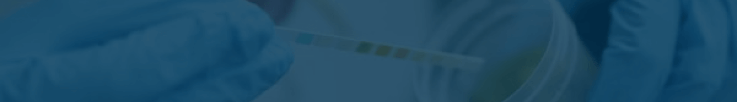 Urinalysis Reagent Strips Urinalysis Reagent Strips