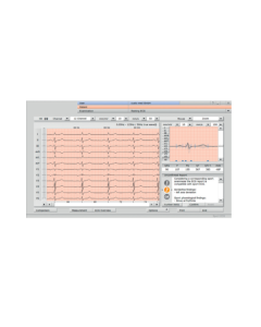 Seca Sport ECG Software Upgrade (According To Seattle Protocol) For Seca CT331 [Pack Of 1]