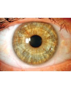 Artiflex Myopia Model 401 6mm/8.5mm U -4.5 40114SW09N [Pack of 1]