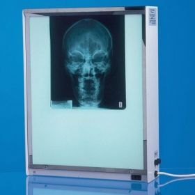 AW Select X-Ray Viewer, Quadruple, with Vertical Fitment