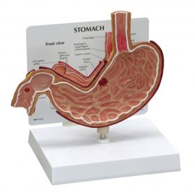 Stomach Ulcer Anatomical Model [Pack of 1]