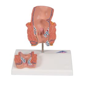 Haemorrhoid Anatomy Model [Pack of 1]