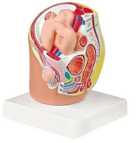 Indirect Inguinal Hernia Model [Pack of 1]