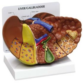 Liver Model with Pathologies [Pack of 1]