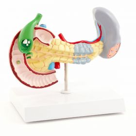 Pancreatic Diseases Model [Pack of 1]